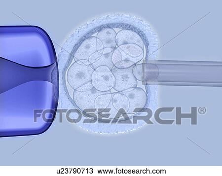 Preimplantation genetic diagnosis View Large Illustration Drawing - Preimplantation genetic diagnosis. Fotosearch