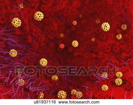 Stock Illustration - Sars virus, artwork. Fotosearch