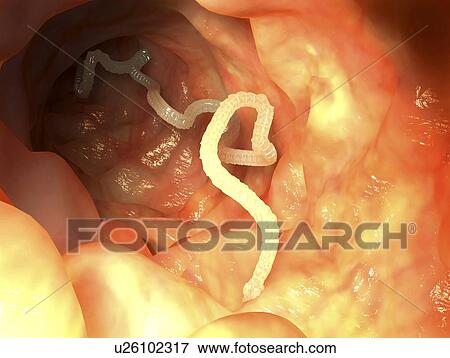 Tapeworm, artwork View Large Illustration Stock Illustration - Tapeworm, artwork. Fotosearch