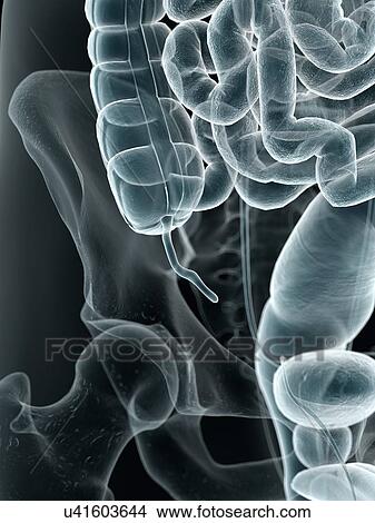 Human appendix, artwork View Large Illustration Stock Illustration - Human appendix, artwork. Fotosearch
