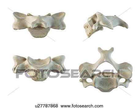 Stock Illustration - Human cervical vertebrae, artwork. Fotosearch