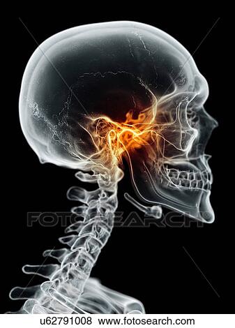 Stock Illustration - Human jaw joint, artwork. Fotosearch