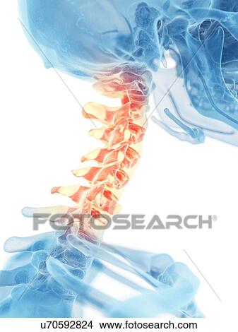 Stock Illustration - Human neck bones, artwork. Fotosearch