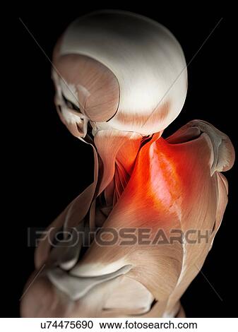 Clipart - Human neck muscles, artwork. Fotosearch