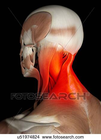 Stock Illustration - Human neck muscles, artwork. Fotosearch