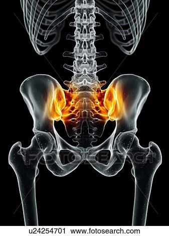 Human sacroiliac joint, artwork View Large Illustration Clip Art - Human sacroiliac joint, artwork. Fotosearch
