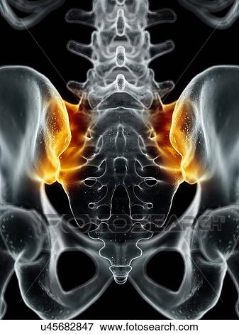 Stock Illustration - Human sacroiliac joint, artwork. Fotosearch