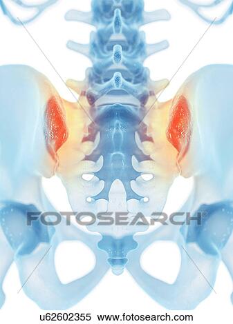 Stock Illustration - Human sacroiliac joint, artwork. Fotosearch