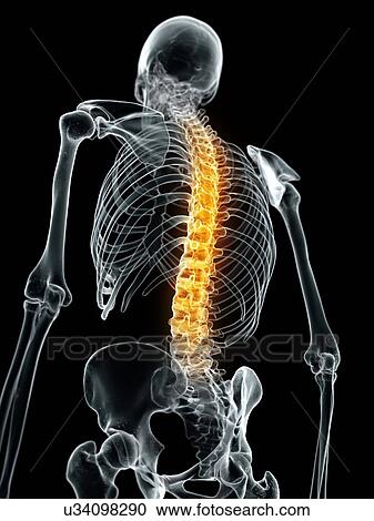 Clipart - Human spine, artwork. Fotosearch