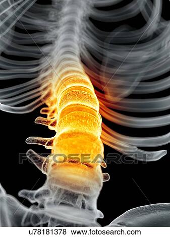 Human spine, artwork View Large Illustration Stock Illustration - Human spine, artwork. Fotosearch