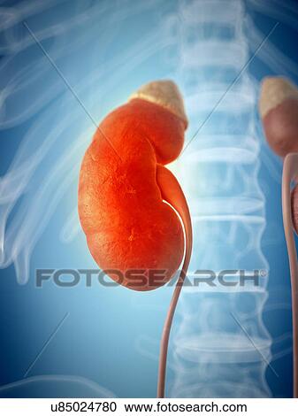 Clipart - Inflamed kidney, artwork. Fotosearch