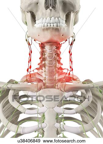 Inflamed lymph nodes, artwork View Large Illustration Stock Illustration - Inflamed lymph nodes, artwork. Fotosearch