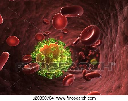 Stock Illustration - HIV infection, artwork. Fotosearch