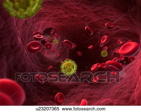 Stock Illustration - HIV infection, artwork. Fotosearch