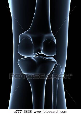 Stock Illustration - Human knee joint, artwork. Fotosearch