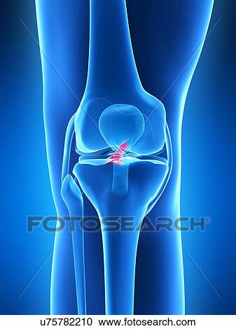 Clipart - Human knee ligament, artwork. Fotosearch