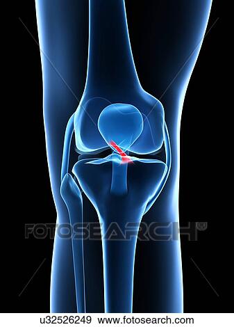 Human knee ligament, artwork View Large Illustration Stock Illustration - Human knee ligament, artwork. Fotosearch