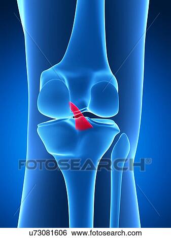 Human knee ligament, artwork View Large Illustration Stock Illustration - Human knee ligament, artwork. Fotosearch