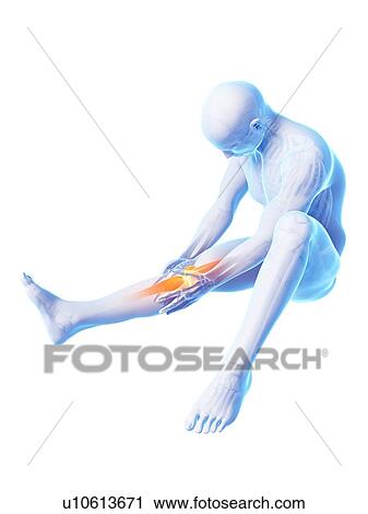 Human knee pain, artwork View Large Illustration Clip Art - Human knee pain, artwork. Fotosearch