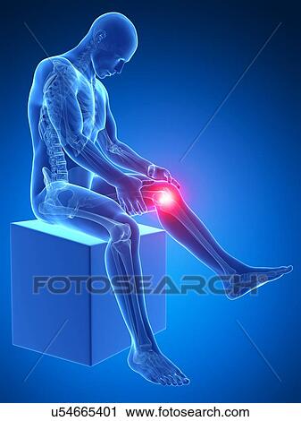 Clip Art - Human knee pain, artwork. Fotosearch