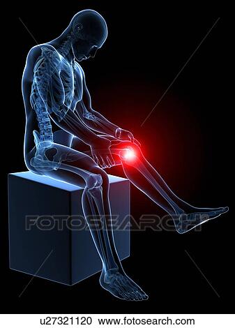 Human knee pain, artwork View Large Illustration Clipart - Human knee pain, artwork. Fotosearch