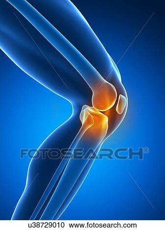 Human knee pain, artwork View Large Illustration Clipart - Human knee pain, artwork. Fotosearch