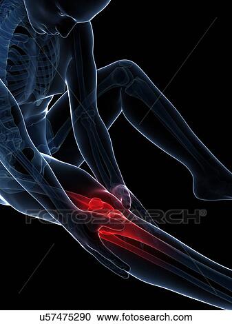 Human knee pain, artwork View Large Illustration Clipart - Human knee pain, artwork. Fotosearch