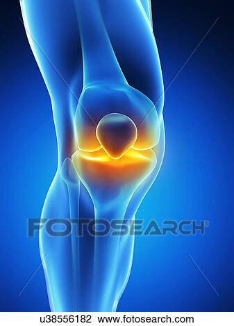 Human knee pain, artwork View Large Illustration Drawing - Human knee pain, artwork. Fotosearch