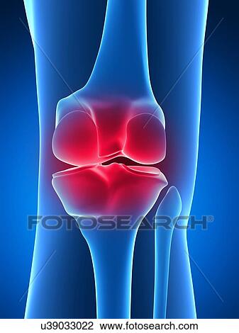 Human knee pain, artwork View Large Illustration Drawing - Human knee pain, artwork. Fotosearch