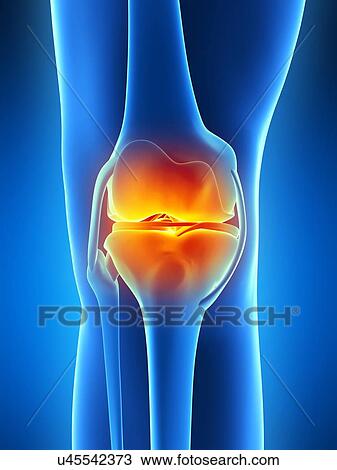 Human knee pain, artwork View Large Illustration Drawing - Human knee pain, artwork. Fotosearch
