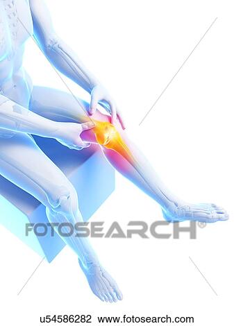 Human knee pain, artwork View Large Illustration Drawing - Human knee pain, artwork. Fotosearch