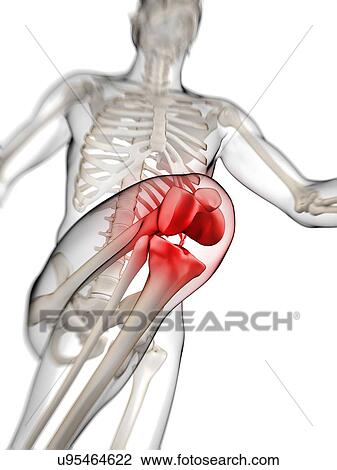 Human knee pain, artwork View Large Illustration Drawing - Human knee pain, artwork. Fotosearch
