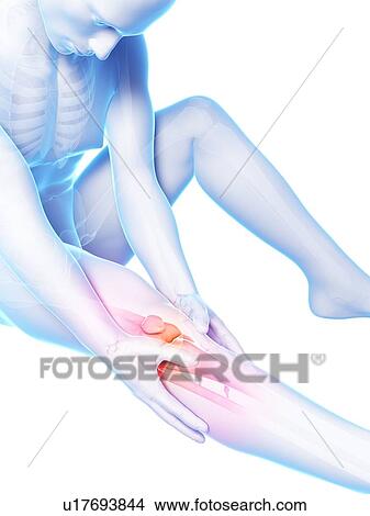 Human knee pain, artwork View Large Illustration Stock Illustration - Human knee pain, artwork. Fotosearch