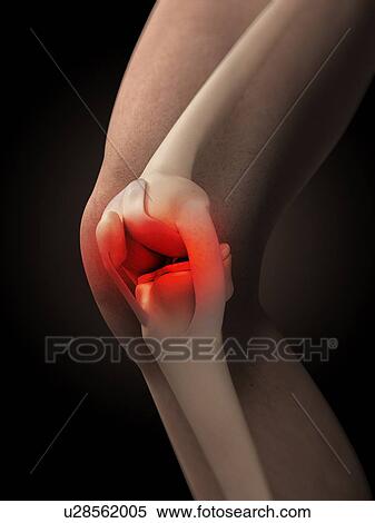 Stock Illustration - Human knee pain, artwork. Fotosearch