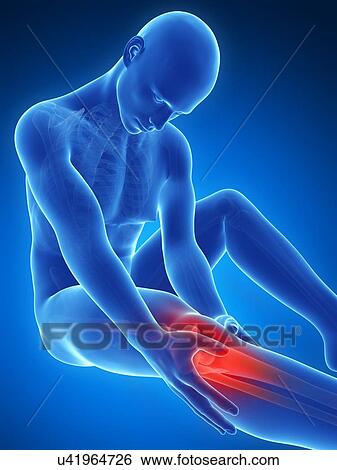 Human knee pain, artwork View Large Illustration Stock Illustration - Human knee pain, artwork. Fotosearch