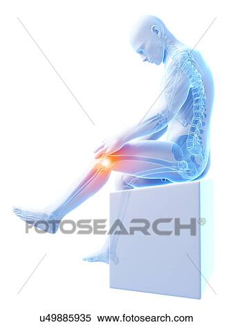 Stock Illustration - Human knee pain, artwork. Fotosearch