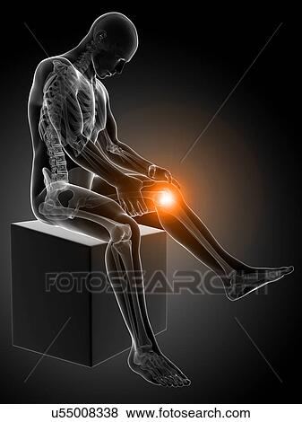 Human knee pain, artwork View Large Illustration Stock Illustration - Human knee pain, artwork. Fotosearch