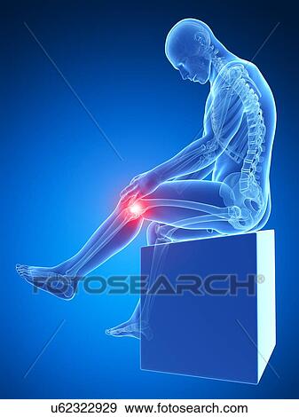 Human knee pain, artwork View Large Illustration Stock Illustration - Human knee pain, artwork. Fotosearch