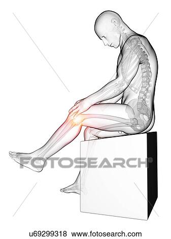 Stock Illustration - Human knee pain, artwork. Fotosearch