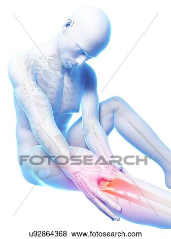 Human knee pain, artwork View Large Illustration Stock Illustration - Human knee pain, artwork. Fotosearch