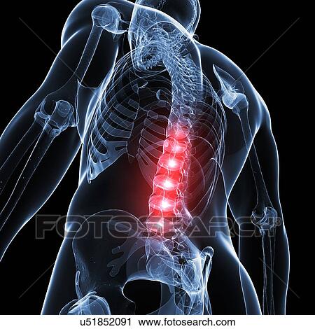 Clip Art - Human lower spine, artwork. Fotosearch