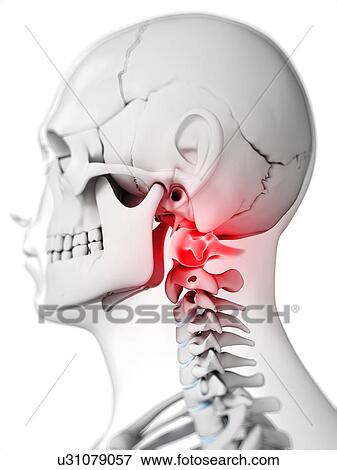 Stock Illustration - Human neck bones, artwork. Fotosearch