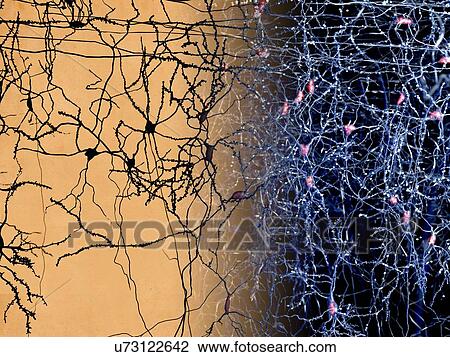 Neuron network, artwork View Large Illustration Drawing - Neuron network, artwork. Fotosearch