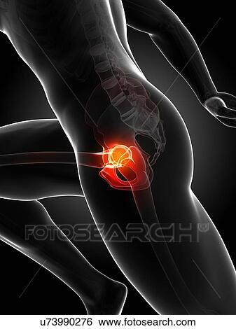 Runner's hip joint, artwork View Large Illustration Stock Illustration - Runner's hip joint, artwork. Fotosearch