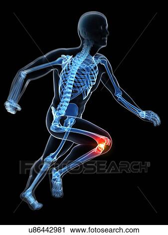 Runner's knee joint, artwork View Large Illustration Clip Art - Runner's knee joint, artwork. Fotosearch