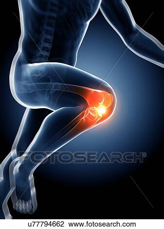 Drawing - Runner's knee joint, artwork. Fotosearch
