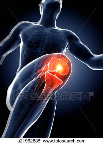 Runner's knee joint, artwork View Large Illustration Stock Illustration - Runner's knee joint, artwork. Fotosearch