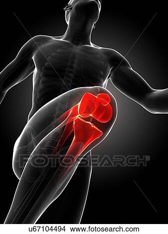 Runner's knee joint, artwork View Large Illustration Stock Illustration - Runner's knee joint, artwork. Fotosearch