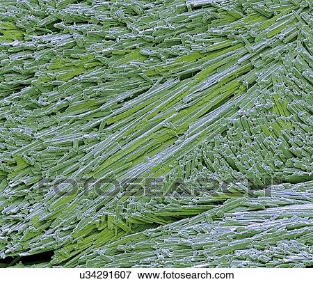 Stock Illustration - Uric acid crystals, SEM. Fotosearch