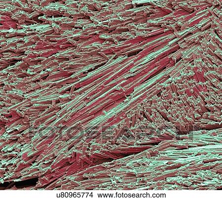 Stock Illustration - Uric acid crystals, SEM. Fotosearch